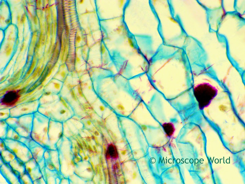 Ranculus under the microscope at 400x magnification.