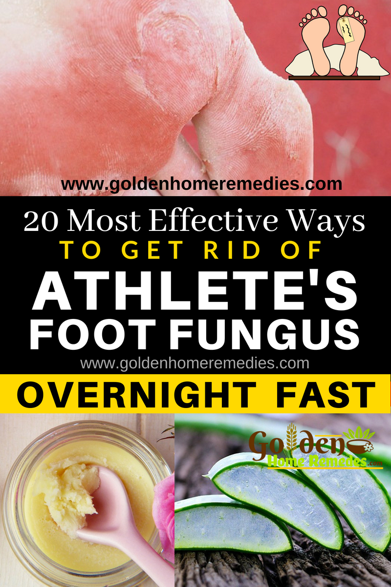 Watch 20 Home Remedies To Get Rid Of Warts On Face, Neck, Hands Fingers video Watch 20 Home Remedies To Get Rid Of Warts On Face, Neck, Hands Fingers video