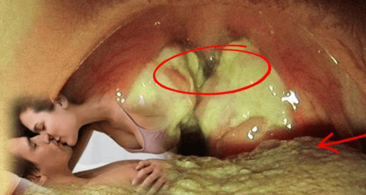 posle-seksa-gorit-vlagalishe