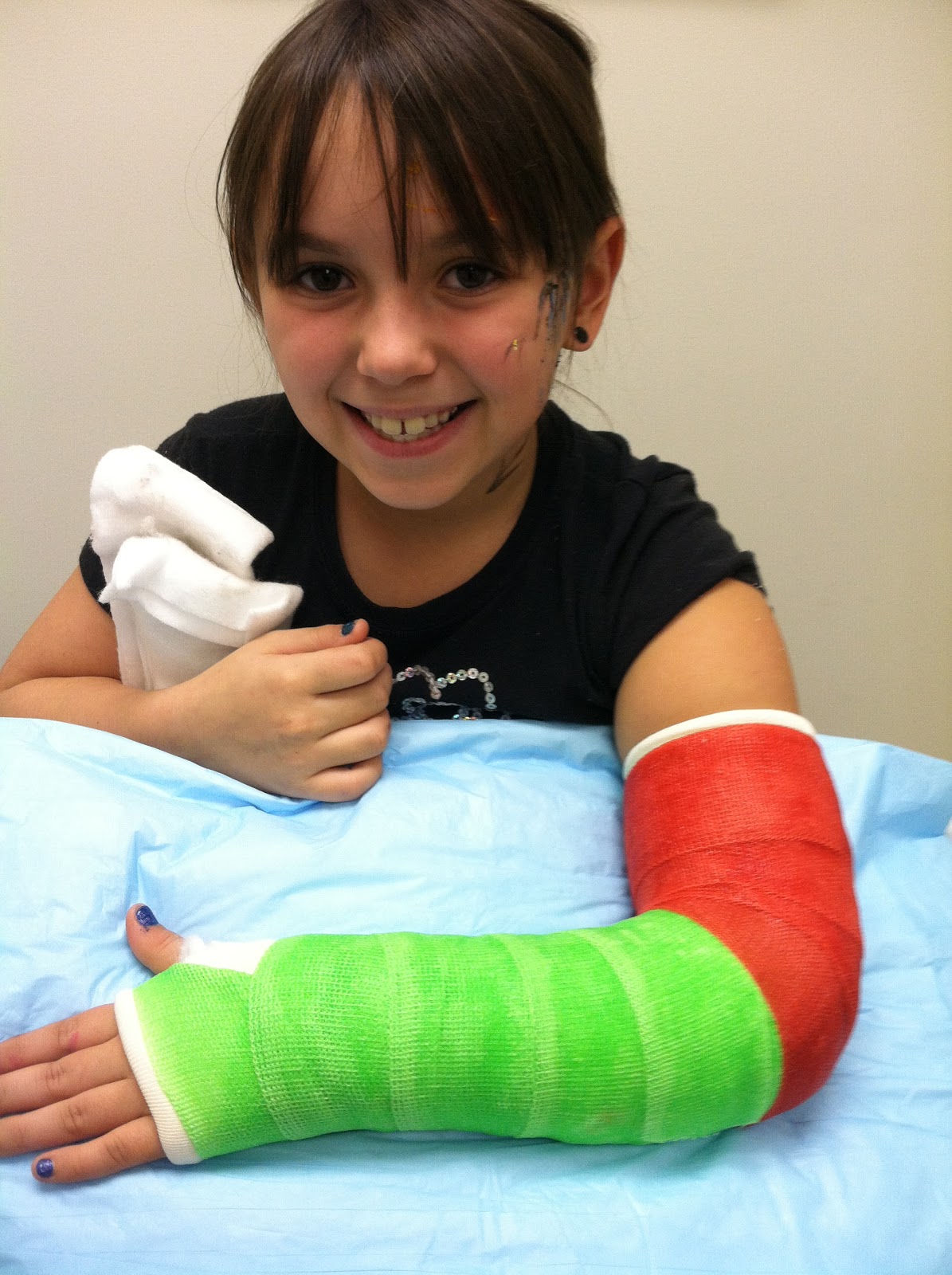 Fooseberry Pie: First Fooseberry Broken Bone