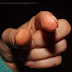Ciemna strona manicure hybrydowego - UCZULENIE