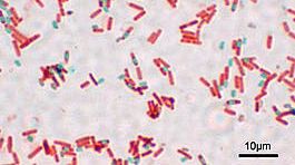 Βακτήρια-Bacillus Subcilis