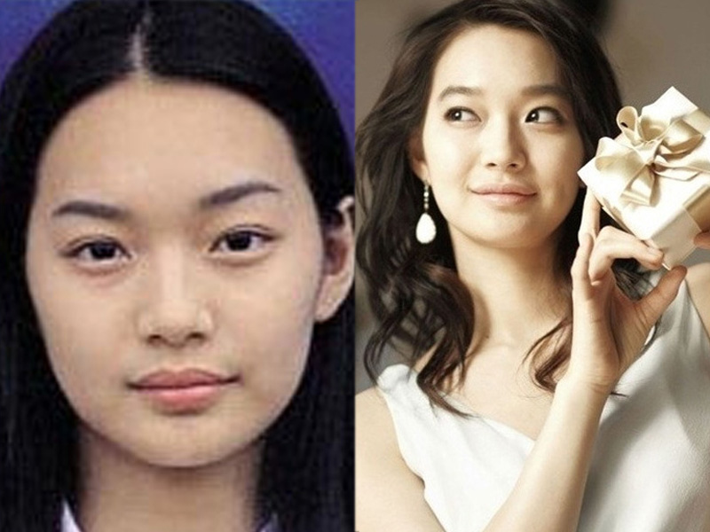 Shin Min Ah, aktris Korea Selatan sebelum dan sesudah melakukan operasi pla...