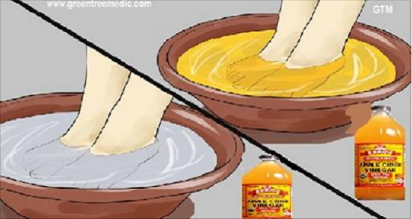 SI EMPAPA SUS PIES EN VINAGRE DE MANZANA, ESTO ES LO QUE SUCEDE ... ESO ES INCREÍBLE! SI EMPAPA SUS PIES EN VINAGRE DE MANZANA, ESTO ES LO QUE SUCEDE ... ESO ES INCREÍBLE!