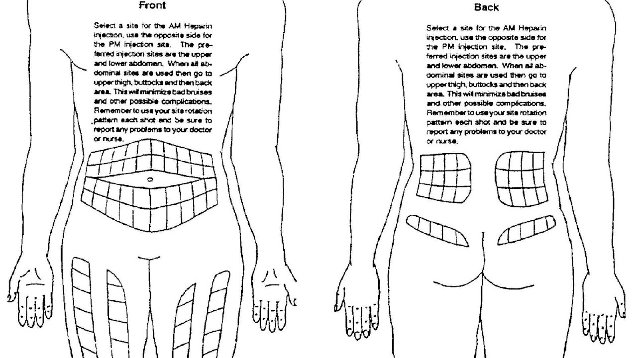 Injection Sites Insulin