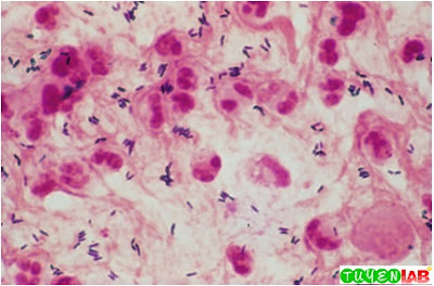 gram stain sputum smear corynebacterium positive atlas monocytogenes microbiology direct microscopy listeria bacilli bacillary examination infections fig light