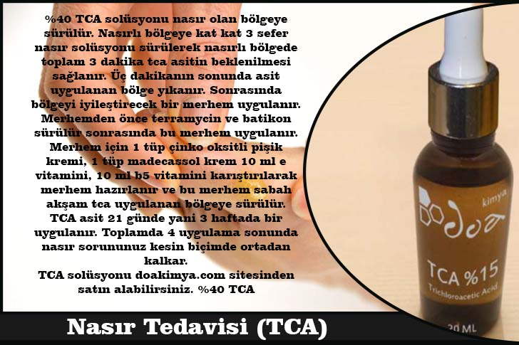 El Ve Ayak Bakimi Nasir Tedavisi