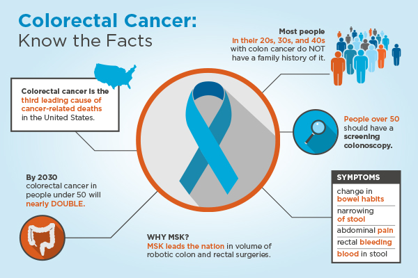 Great Narrowing Of Stool of all time Learn more here | stoolz