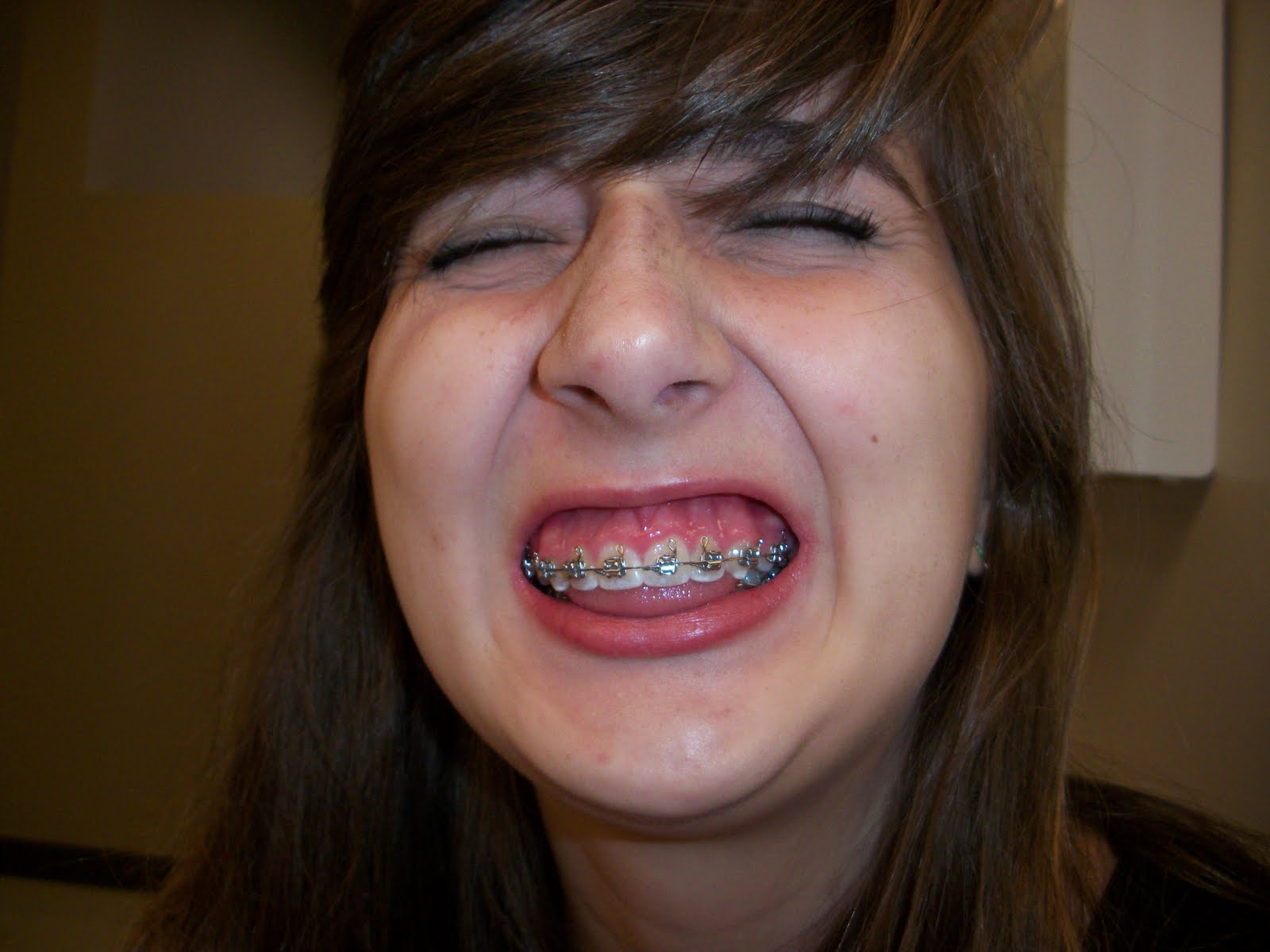 My Small Mouth Pictures days 13