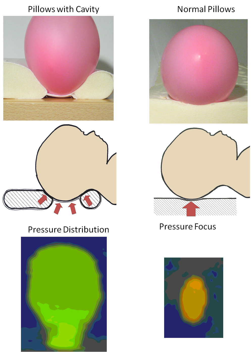 Specially Designed Baby Pillow for Plagiocephaly and Brachycephaly