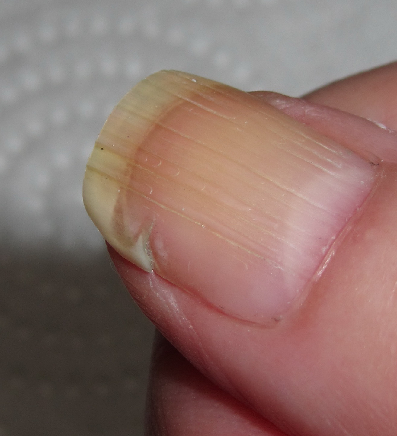 Marias Nail Art and Polish Blog: 1½ months of repairing a ripped/torn nail with a teabag – 1½ mdr. med reparation af revnet negl med