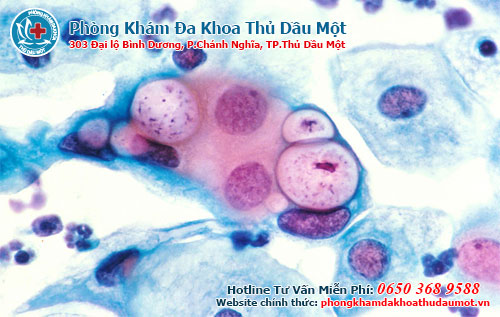 su-giong-nhau-va-khac-nhau-giua-benh-lau-va-chlamydia.jpg