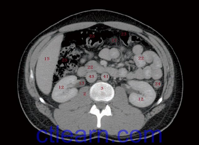 Male Abdomen and Pelvis CT Scan