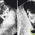 10 Foto Penampakan Ultrasonografi (USG) yang Menakjubkan