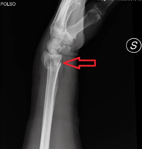 A Cosa Serve La Radiologia Al Fisioterapista