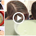 Transform Your Thinning Hair Overnight With Only 1 Solution