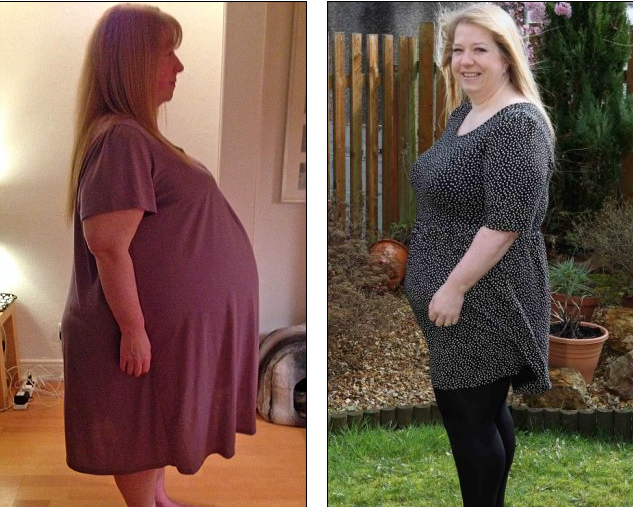 Ovarian Cyst Miracle 101 5 Shocking And Extreme Cases Of Large Ovarian