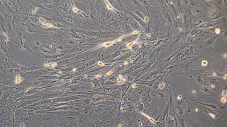 examples of stem cells