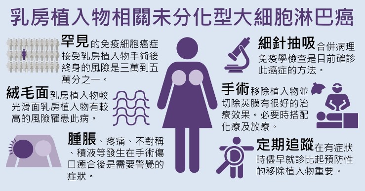 乳房植入物相關未分化大細胞型淋巴癌BIA-ALCL-照護線上