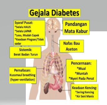 Gejala Sakit Gula - Blog Trending