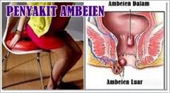 Foto JUAL OBAT BAB ANAK BERLENDIR SEPERTI INGUS