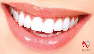 Nha khoa quận 10 BS Mai Xuân Ngọc bọc răng sứ Nha khoa quận 10 BS Mai Xuân Ngọc bọc răng sứ