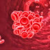  Pengertian Hemofilia dan Hemostatis