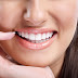 Tẩy trắng răng duy trì được bao lâu phải tẩy lại