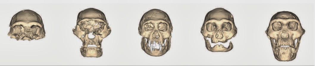 Remarkable variation seen in Skull 5 from Dmanisi