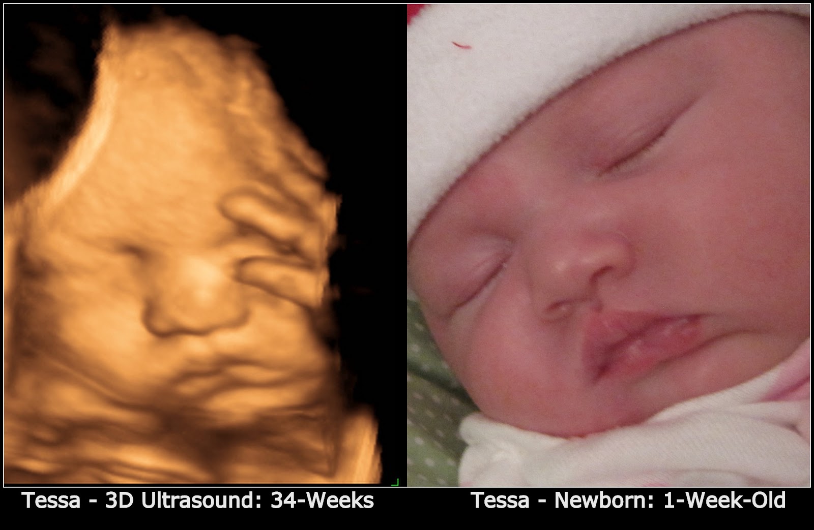 Cute Ultrasound Pics Page 11 BabyCenter