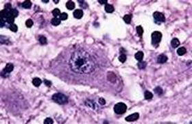 Penyakit Rabies (Gejala Klinis, Type Rabies & Cara Diagnosa
