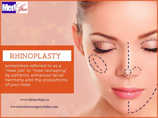 Rhinoplasty Surgery: WHY , HOW and WHERE