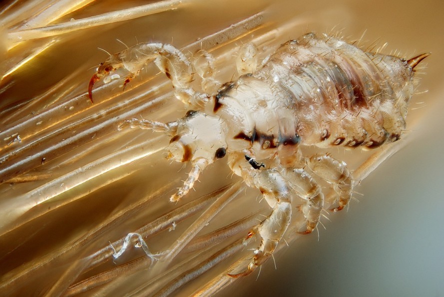 Speedy Freaks Here are some natural cures to help fight super lice
