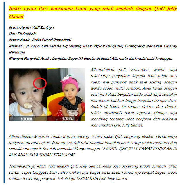 Cara Menghilangkan Benjolan Kecil Di Belakang Leher Secara Alami Cara Menghilangkan Benjolan Kecil Di Belakang Leher Secara Alami