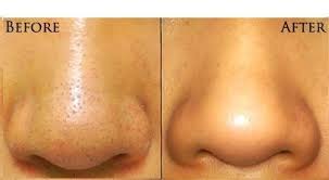 cilt bakimi evde pratik