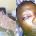 SHOCKER: Soldiers pluck out Road Safety Officer's Eye for begging them to stop torturing a man