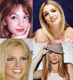 Celebrity Plastic Surgery Before Age 25