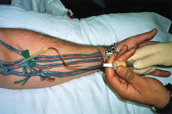 medical-laboratory-and-biomedical-science-tattoo-your-veins-for-blood-draw