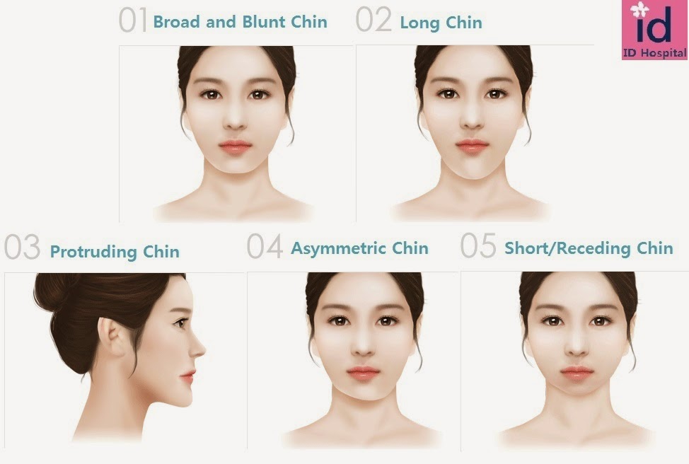 ID Hospital Korea: The most effective chin surgery – ID Hospital’s Mini ...