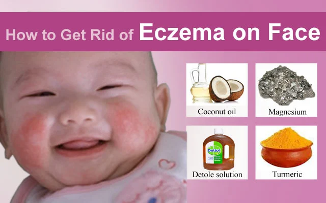 Dynamic How To Get Rid Of Eczema Quick Wallpaper for Mobile