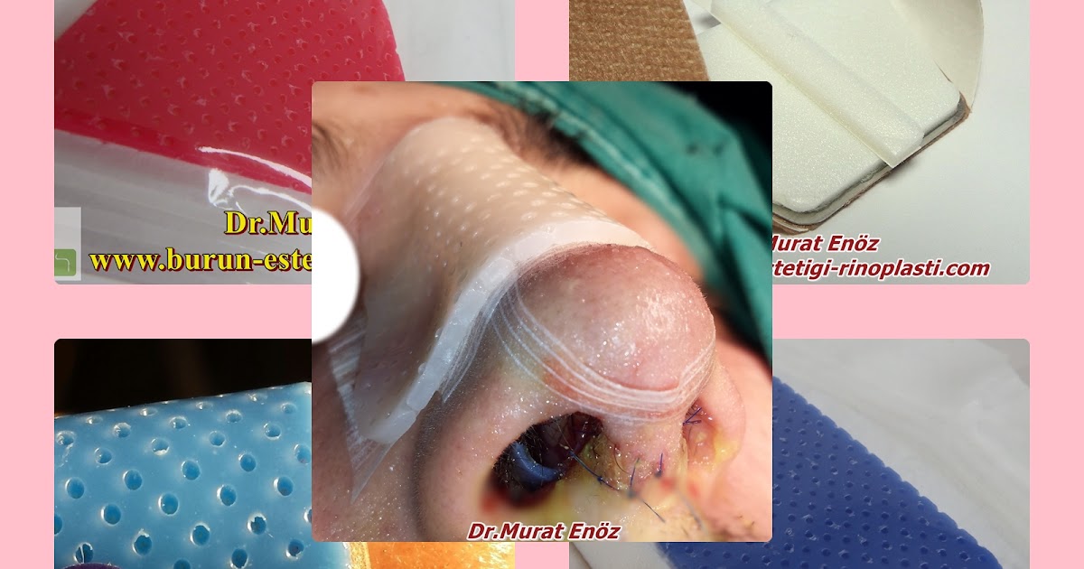 Burun Ateli Nedir, Ne Ise Yarar, Hangi Çesitleri Mevcuttur?