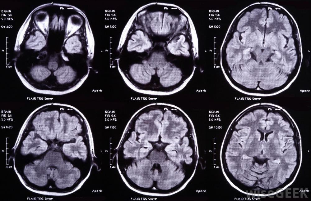 Clermont Radiology s Medical Imaging Blog Can Brain Imaging Help With clermont-radiology-s-medical-imaging-blog-can-brain-imaging-help-with