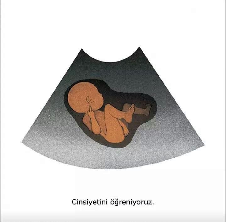 istanbul hanimefendisi nin bebek gunlugu 13 14 hafta pambik kiz mi erkek mi