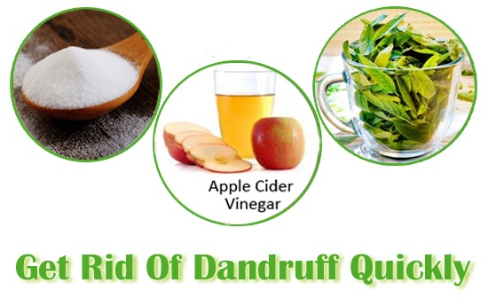 Home Remedies For Dandruff Using Lemon Home Remedies For Dandruff Using Lemon