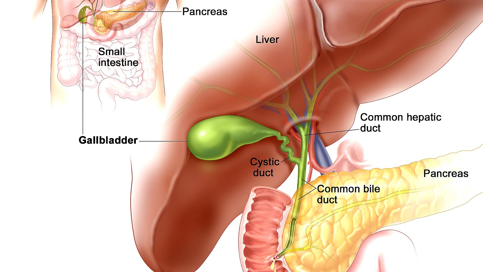 Effects After Gallbladder Removal Effect Choices