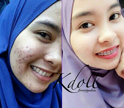 K Doll Beauty Skin Cantik Belaka