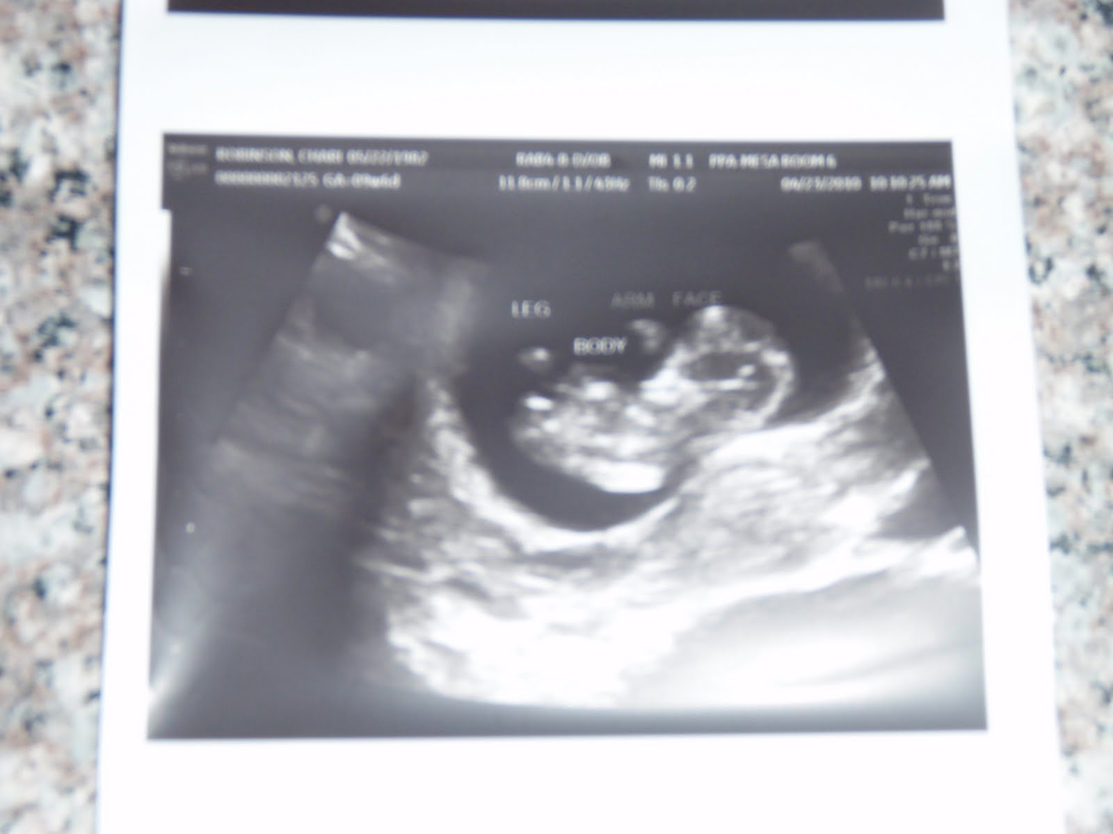 The Robinson Clan: Pregger Pics