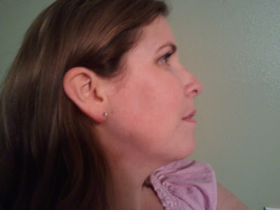 side jaw jenn surgery swollen left right