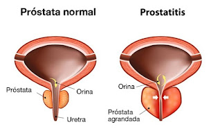 protatisis