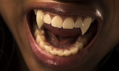 8 νεκροί "βρικόλακες"! Συνεχίζεται το κυνήγι εναντιόν των βρικολάκων του Μαλάουι  